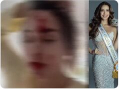 Skandal në Kanë/ Miss Venezuela publikon videon tronditese me fytyrën e mbuluar në gjak, akuzon stilistin e njohur per dhunë